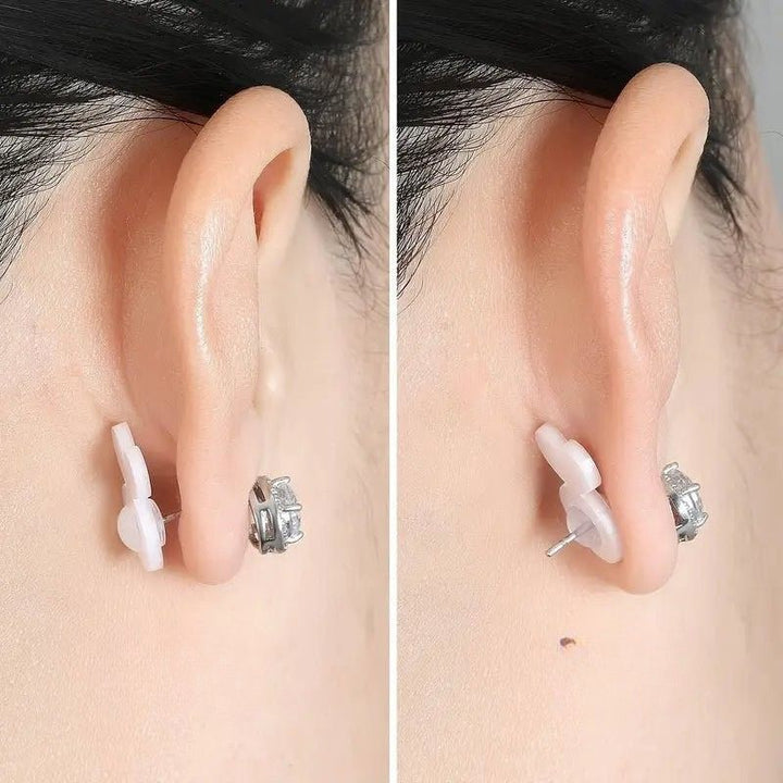 Elanti™ - Instant Fix for Drooping Earrings (2+3 Free)